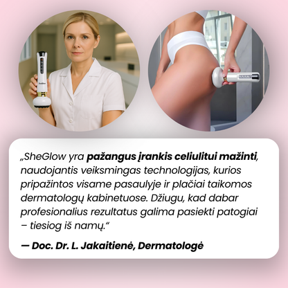 Dermatologės rekomendacija: pažangus SheGlow celiulito masažuoklis su profesionaliais rezultatais namų sąlygomis